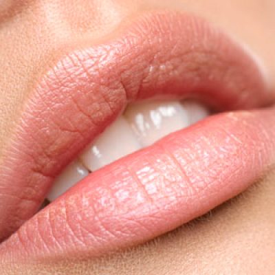 Lip Fillers Reading